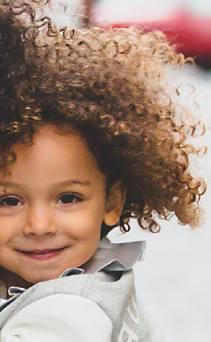 SKYDINE ORTHOCAREpedic implants for paediatrics 