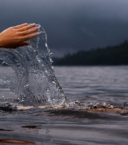 Orthopedic implants for Hands by Madison