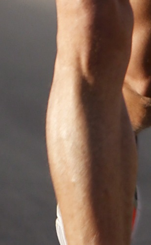 Orthopedic instruments and implants plates for knee by Madison