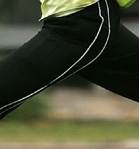 Orthopedic hip implant plates and instruments by Madison