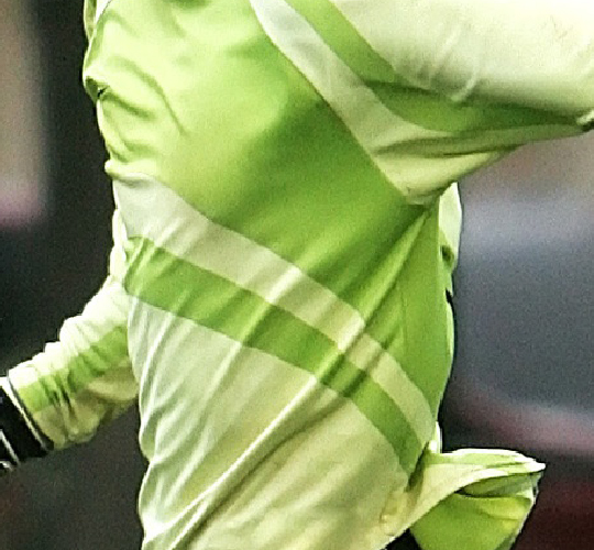 SKYDINE ORTHOCARE Rib Fixation Plates 