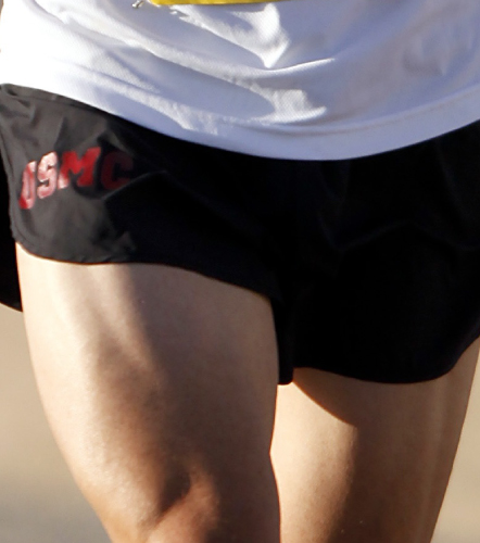 Orthopedic instruments and implant, plates for femur by Madison